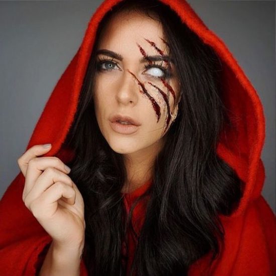 femme défigurée